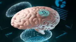 بشرى لمرضى الشلل.. شريحة في الدماغ قد تتيح التحكم بالأدوات