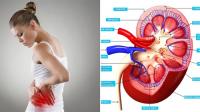 5 علامات تكشف الإصابة بأمراض الكلى..اكتشفيها