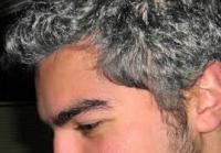 اكتشاف الجينة المسؤولة عن الشيب