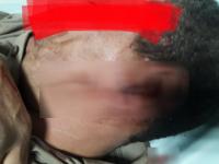 خطير... اعتداء على موظف جماعي أمام منزله ونقله للمستشفى بين الحياة والموت