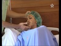 زوج يشوه وجه زوجته القاصر بشفرة حلاقة بسبب طلبها الطلاق