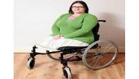 أربعينية تفقد قدميٌها بسبب التدخين