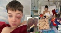 أعراض نادرة لفيروس كورونا تتسبب لطفل بالعمى المؤقت