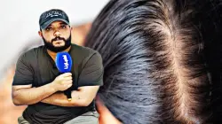 خبير يكشف الحقيقة وراء تساقط الشعر… وهذه أفضل الحلول