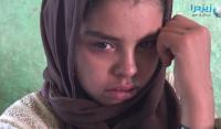 نداء إنساني من أسرة طفلة مصابة بالتهاب السحايا