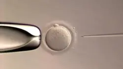 ثورة في الطب: ولادة أول طفل بعملية تخصيب كاملة من تنفيذ ذكاء اصطناعي