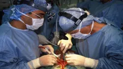 لأول مرة في العالم.. زراعة كبد خنزير في جسم إنسان