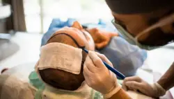 وفاة غامضة لبريطاني في إسطنبول قبل خضوعه لعملية زراعة شعر