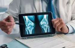 أغذية تُقوي العظام عند الشيخوخة وتقينا من الكسور