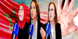 نايضة فالبرلمان بسبب الانتشار المتزايد لمرض بوحمرون ونائبات يفجرن حقائق خطيرة