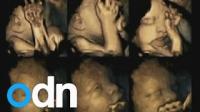 شاهد خطورة تأثير التدخين على الجنين في رحم أمه