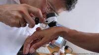 ثمانية تغيرات على جلدك تنبئك بأمراض في الكبد والأمعاء