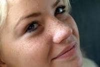 أشياء تسبب ظهور النمش ،ابتعدي عنها