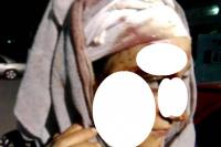 تطورات جديدة في قضية "المستشارة الحركية" التي مزقت وجه جارتها ومنعت نقلها عبر سيارة إسعاف الجماعة