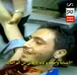 شهيد يبتسم و هو يحتضر +18