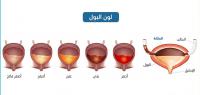 ما هي العلاقة بين لون البول وصحتك؟