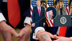 ترامب يكشف السرّ وراء ظهور كدمات على يده
