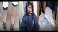معاناة متشرد مع المرض بالحي المحمدي بالبيضاء.