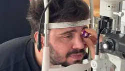 شاب تركي يفقد بصره جزئياً بعد خدش بسيط من قطة ضالة