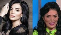 الممثلة المصرية حورية فرغلي تفكر في الاعتزال بسبب عيب خلقي