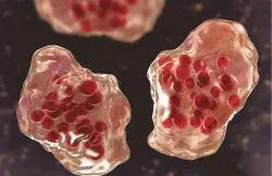 مرض شديد العدوى يضرب مدينة أمريكية كبرى ويهدد الملايين