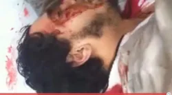 اصابة خطيرة لمعتقل سياسي
