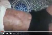 قاسي..سرطان دم يفتك بجسم رجل أربعيني وابنته تناشد المحسنين