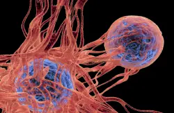 ابتكار علاج يقضي على الأورام لدى أغلب مرضى سرطان المثانة عالي الخطورة