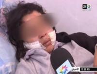 زوج يشرمل زوجته بشفرة حلاقة بمراكش