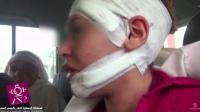زوج يشرمل وجه وجسد زوجته بألة حادة ويختطف ابنتها