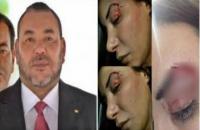 أبيضار تُهدد : بغيت نتلاقى الملك أو بنكيران .. عندهوم 48 ساعة ولا غا ندير اللجوء السياسي