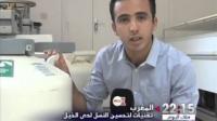 آخر تقنيات التلقيح الاصطناعي وتحسين النسل لدى الخيل