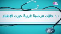 أغرب الحالات المرضية التى حيرت الأطباء