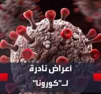 الكشف عن أعراض جديدة ونادرة لـفيروس "كورونا"