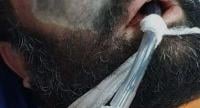 هذا ما قاله الدكتور المغربي "الطيب حمضي" عن مرض "الفطر الأسود" الذي بدأ يثير الهلع في العالم