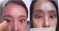 تقوم بعملية تجميلية على عينيها فتحرم من إغلاقها