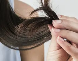 فرد الشعر بالبروتين يتحول إلى كارثة صحية لشابة في الدار البيضاء