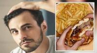 أطعمة ينصح تجنبها لإيقاف تساقط الشعر