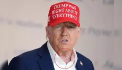 ترامب في موقف محرج بعد ظهور بقعة مكياج واضحة خلال مؤتمر صحفي