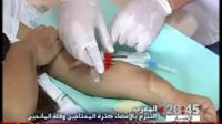التبرع بالأعضاء في المغرب .. كثرة المحتاجين وقلة المانحين