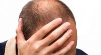 كيف يمكن وقف تساقط الشعر وزيادة نموه؟