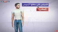 ما الأمراض التي تنقلها بعوضة "زيكا"
