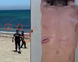 الخطاب الزائف.. حقوقيو إسبانيا بكوا على الكلاب وصمتوا أمام تعنيف شرطتهم للمغاربة في سبتة المحتلة