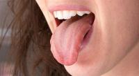 كيف تعرف حالتك الصحية من لسانك؟