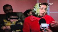كلب بيتبول ينهش وجه طفل صغير نواحي مراكش