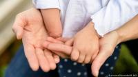 أسباب التشوهات الخِلقِية عند الأطفال!