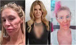 قالت إنها أصيبت به في المغرب.. نجمة هوليوودية تظهر ابتسامتها بعد سنتين من معاناتها مع طفيلي شوه وجهها