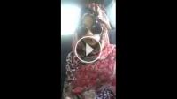 يشوه وجه فتاة بالسكين بإنزكان .. شوفو شنو دار ليها