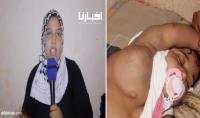 فيديو صادم: مشينا "لميرزكو" جراو علينا والطبيب طلب لينا مليون ونص للعملية وحنا مفحالناش
