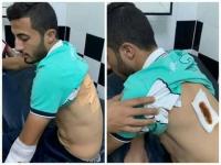 لاعب الوداد أيمن الحسوني يتعرض للطعن من طرف مجهولين